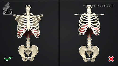 Posturální stabilizace - Patologie
